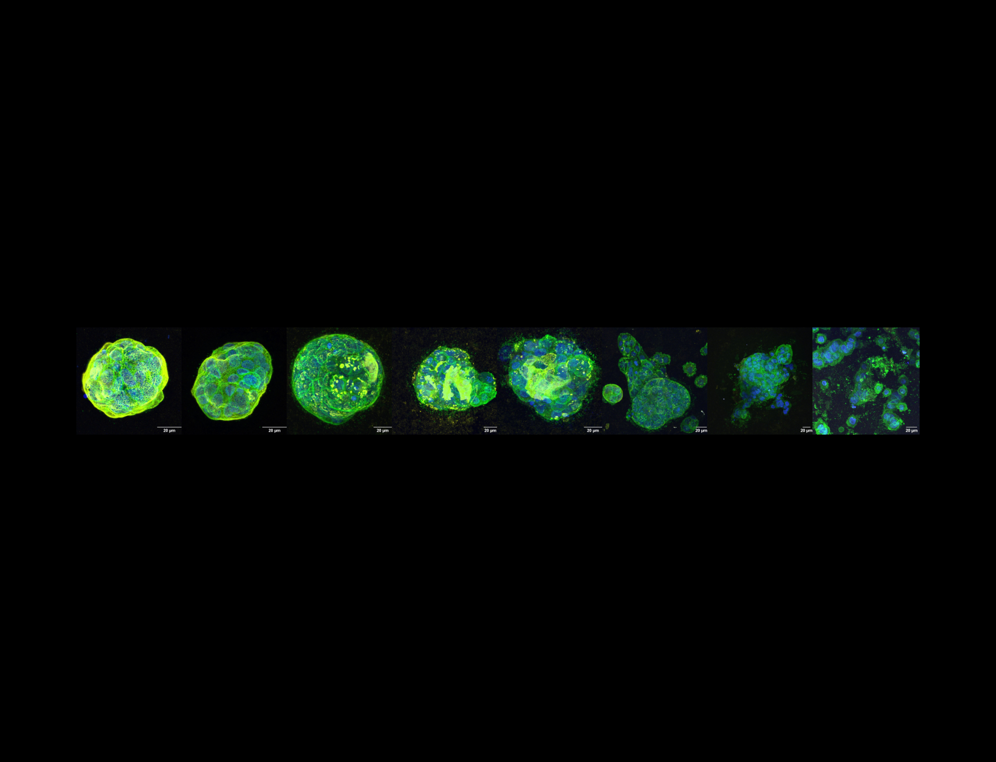 Response of mature acini to high-stiffness microenvironments