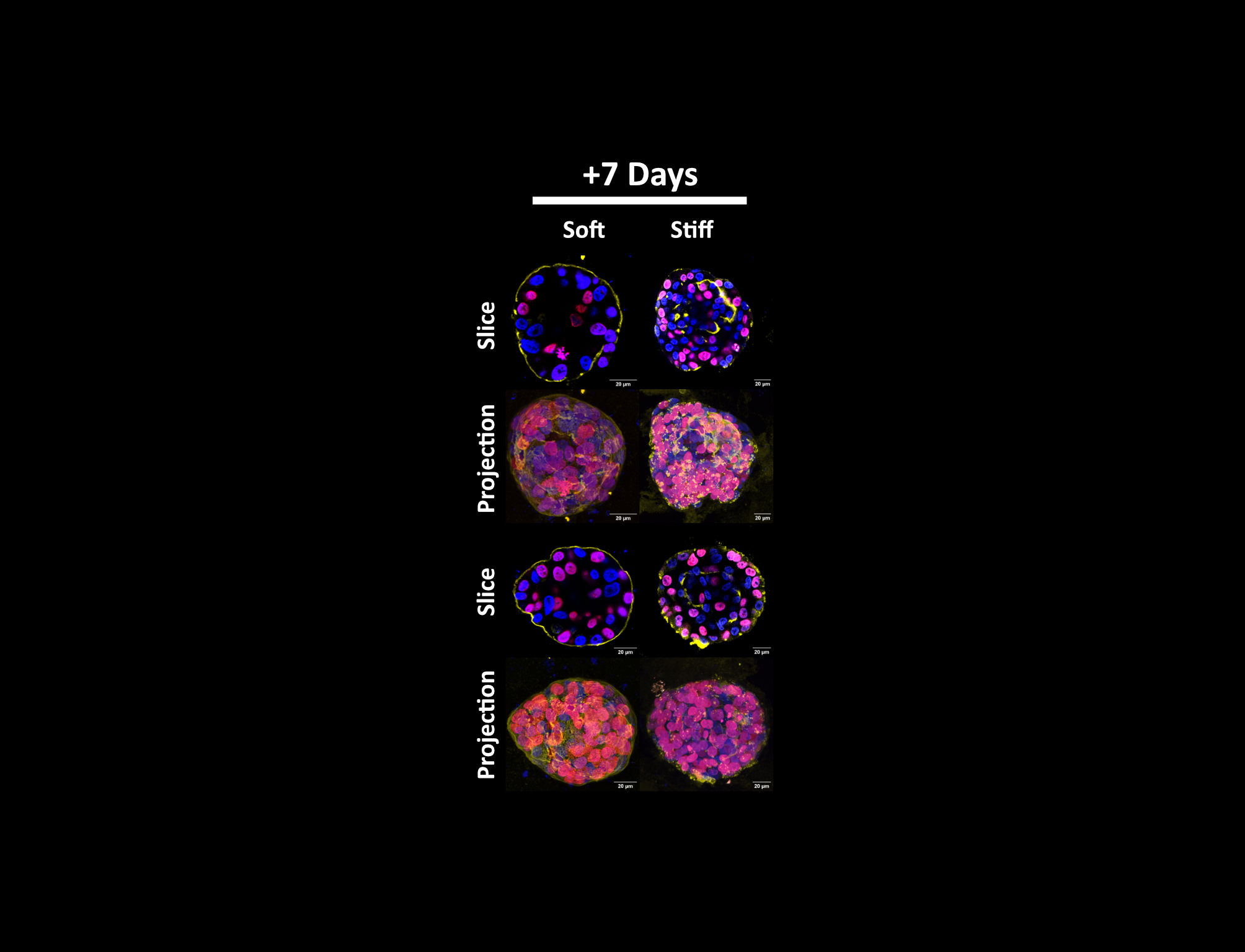 Investigating changes in cell proliferation in response to stiffness