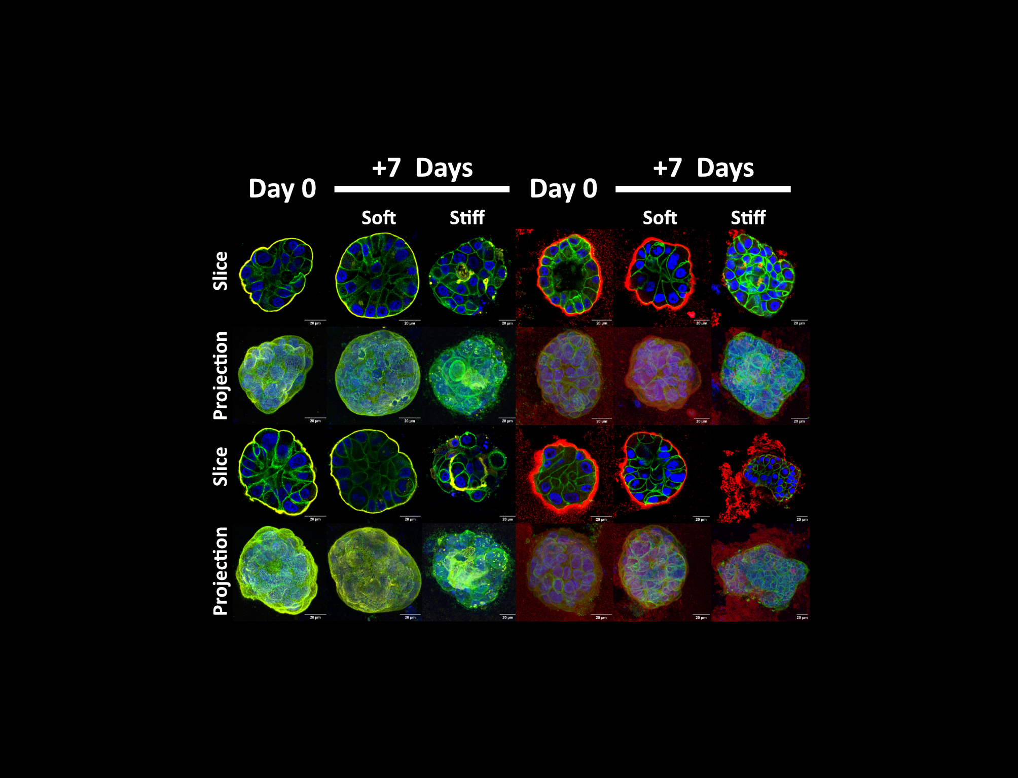 Basement membrane disorganisation in response to stiffness