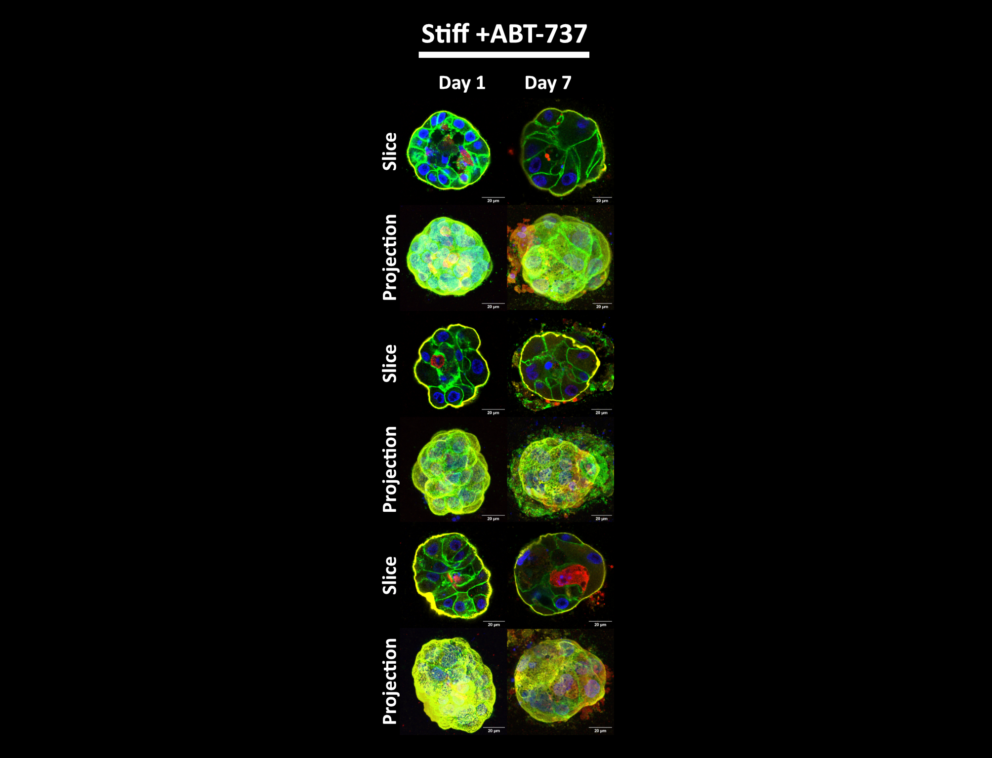 Investigating the ability of ABT-737 to restore the phenotype of acini transferred to stiff gels