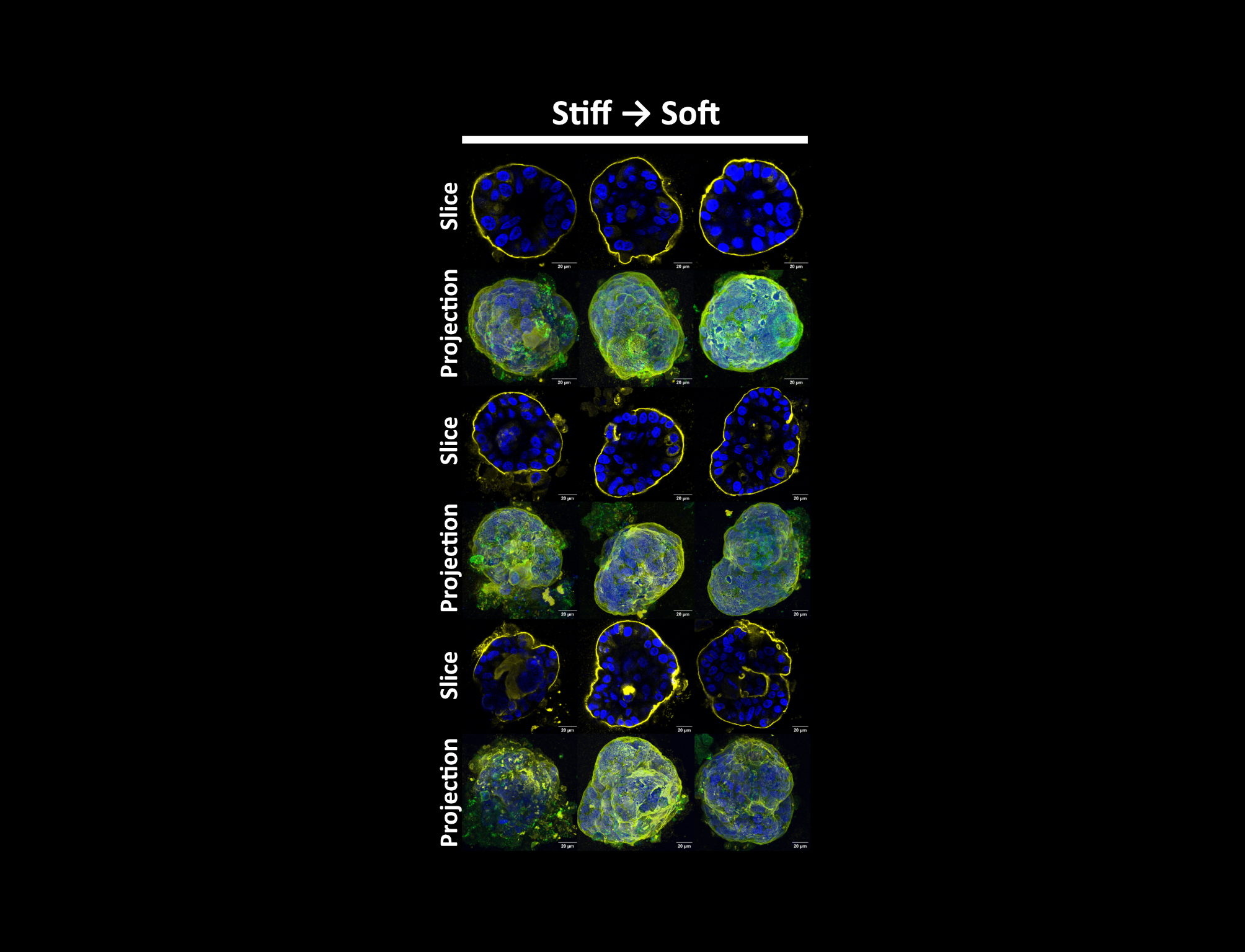 Reversibility of the stiffness-induced phenotype