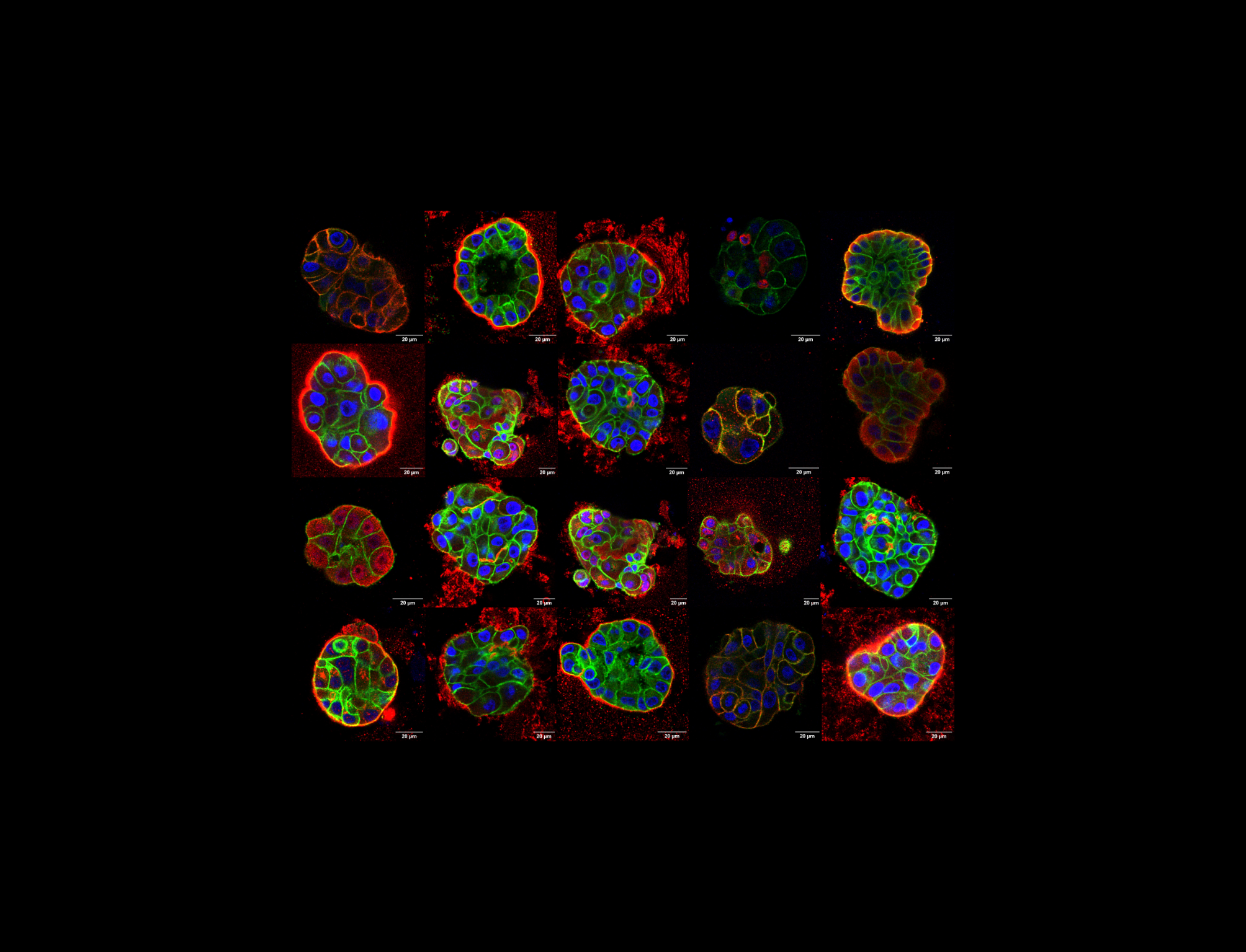 Understanding the (mis)localisation of proteins in response to stiffness