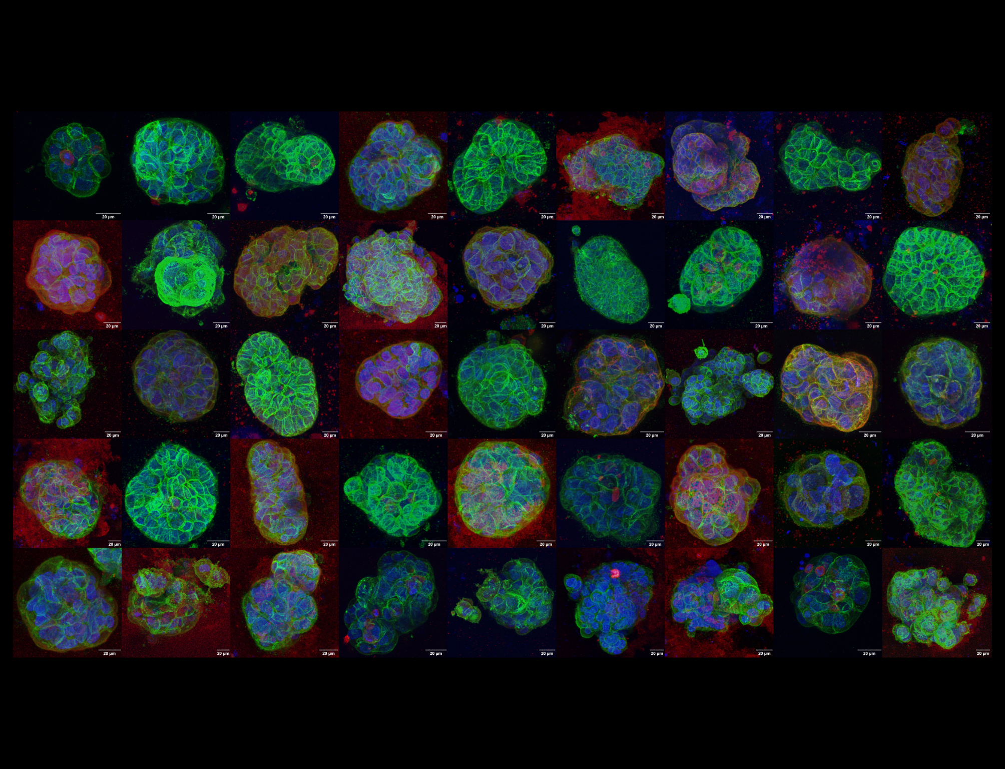 Understanding the (mis)localisation of proteins in response to stiffness