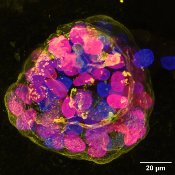 Beating breast cancer: Understanding how tissue stiffness affects cancer rates.