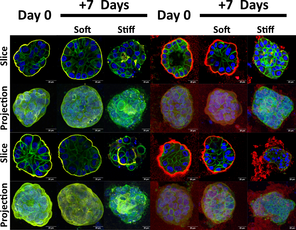 Microscopy images showing the effects of soft vs stiff environments on acini over 7 days