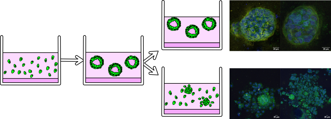 Experimental setup showing cells in different gel environments and microscopy images of acini formation